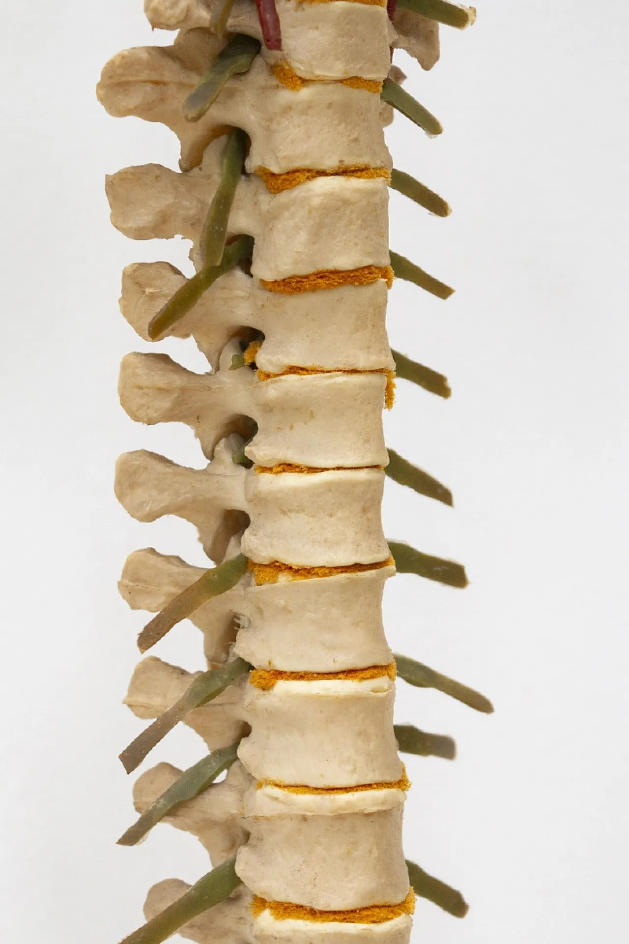 Modello colonna vertebrale, anni '60 4