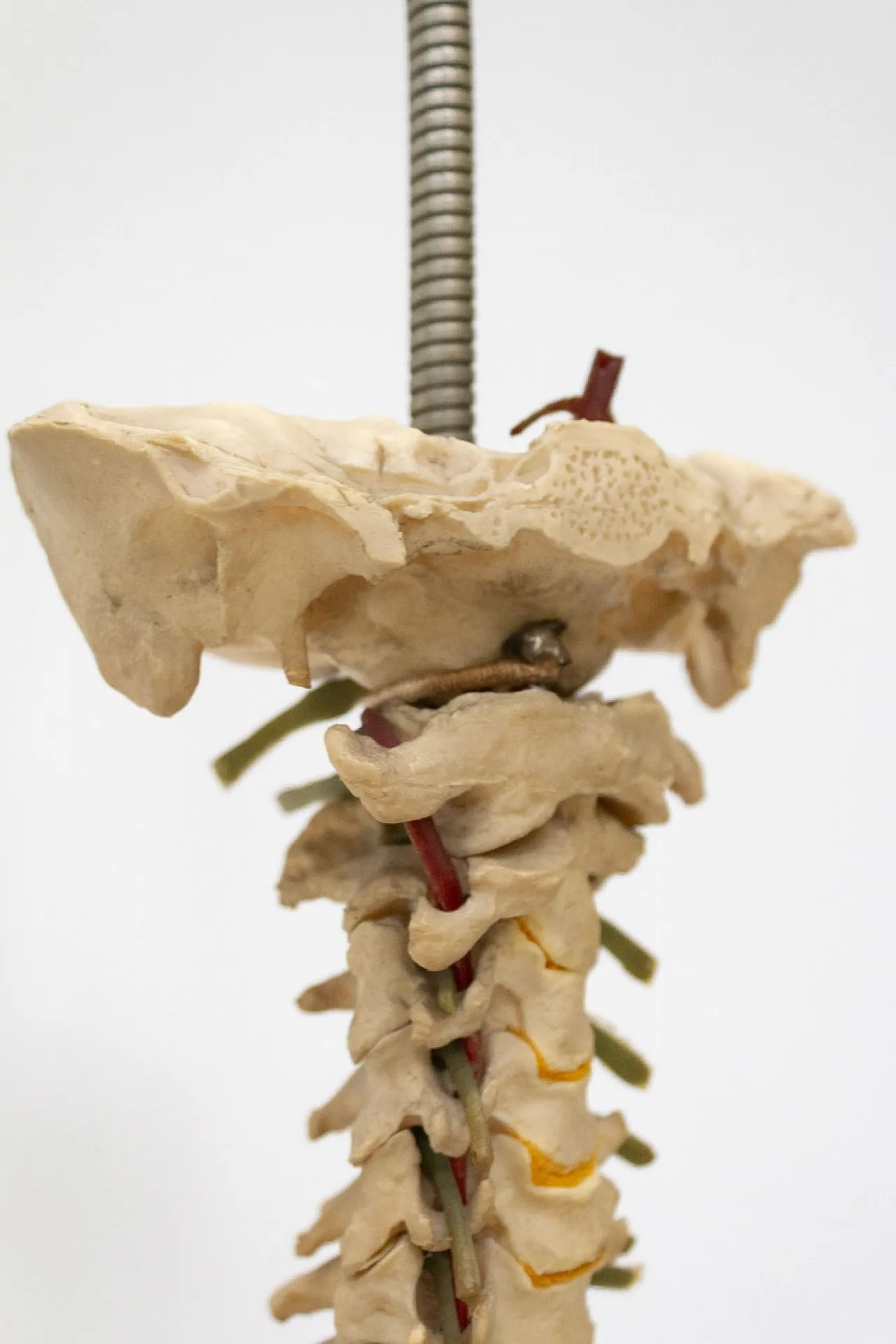 Modello colonna vertebrale, anni '60 6